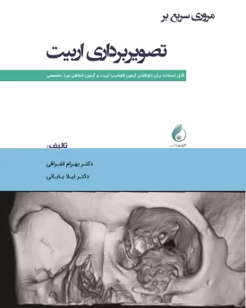 مروری سریع بر تصویربرداری اربیت